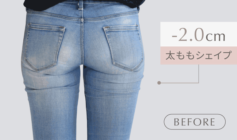 太ももシェイプ -2.0cm