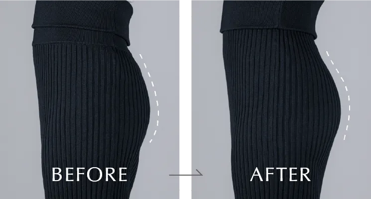 BEFORE / AFTER