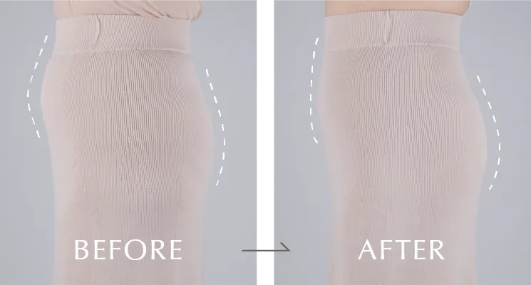 BEFORE / AFTER