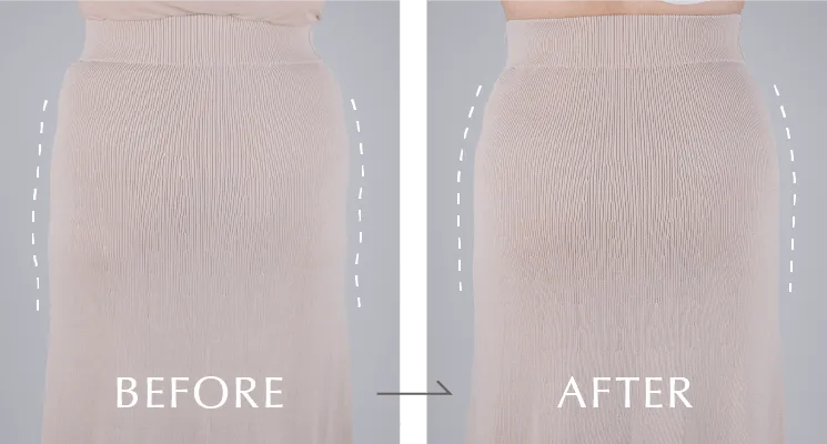 BEFORE / AFTER