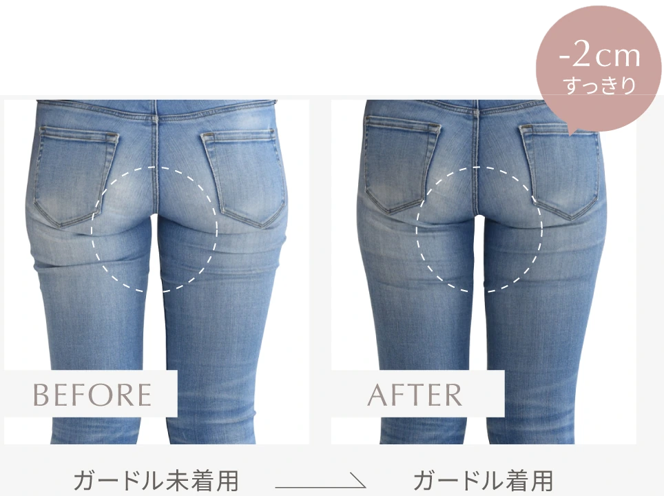 ガードル未着用とガードル着用の比較（-2cmすっきり）