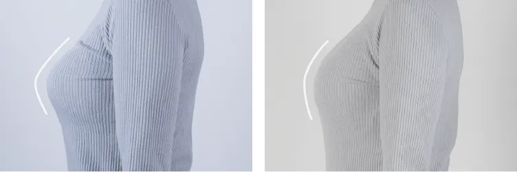 側面ビフォーアフター