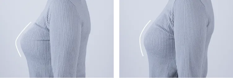 側面ビフォーアフター