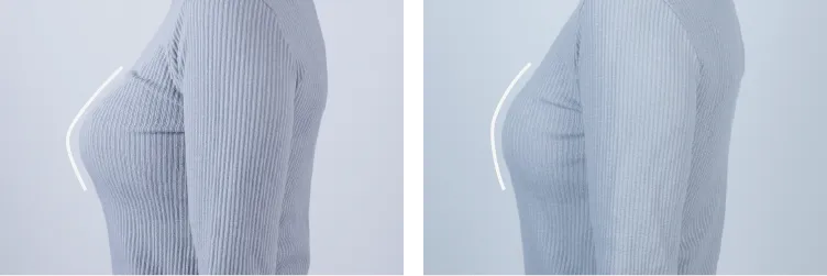 側面ビフォーアフター