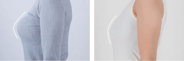 側面ビフォーアフター